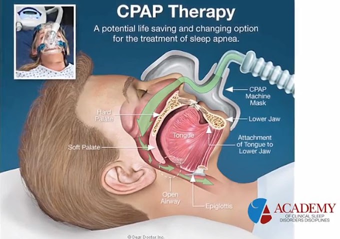 SLEEP APNEA: Causes and Treatment - Interview to Dr. Mark Levy