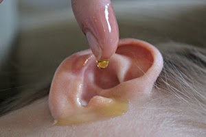 Puissant Remède  maison contre le cérumen et infections de l'oreille