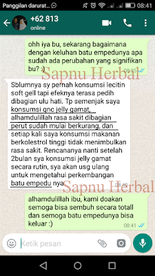 Penyebab & Cara Mengobati Nyeri Perut Bagian Bawah Secara Alami