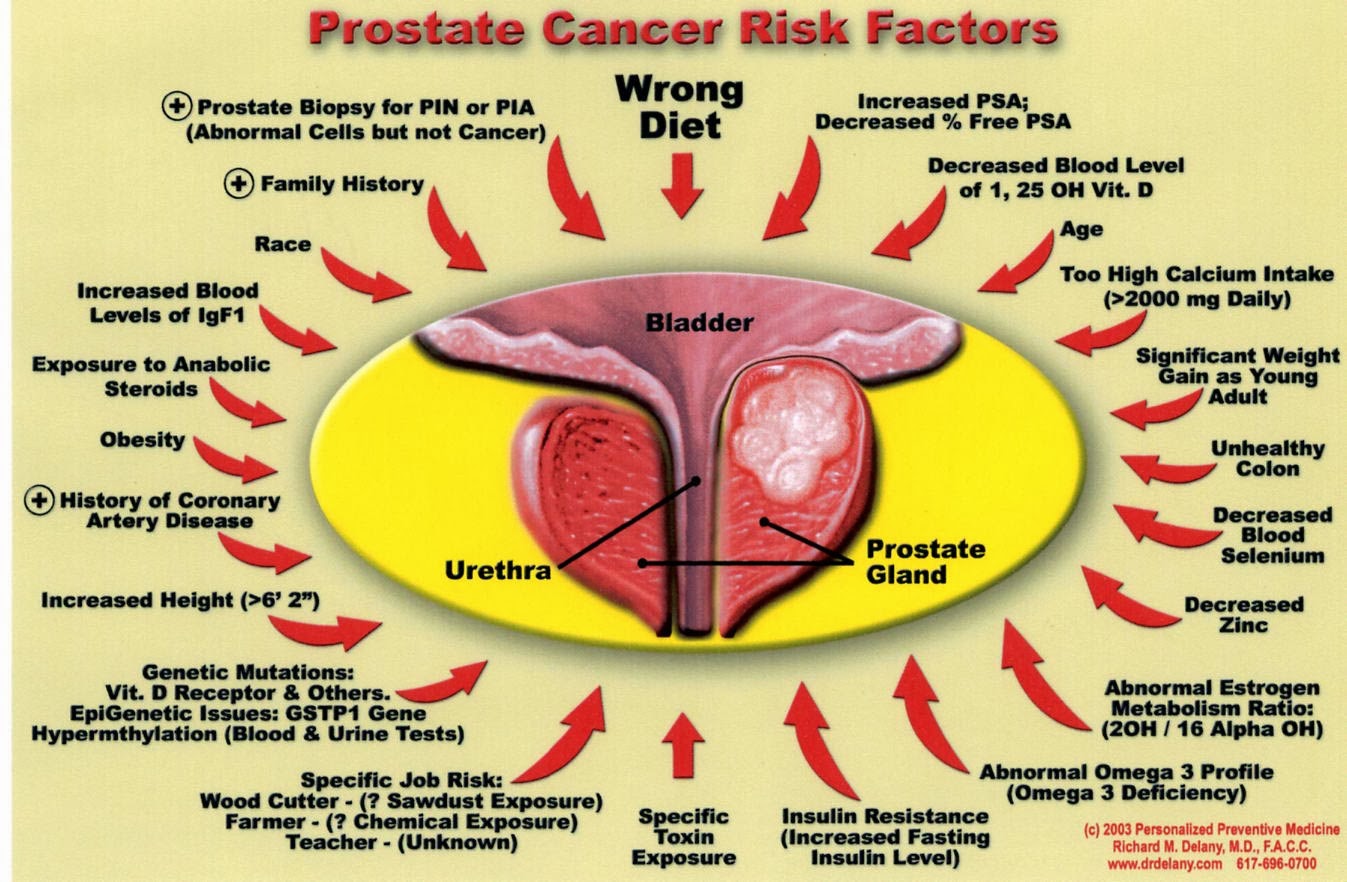 Prostate-Cancer-Risk-Factors.jpg