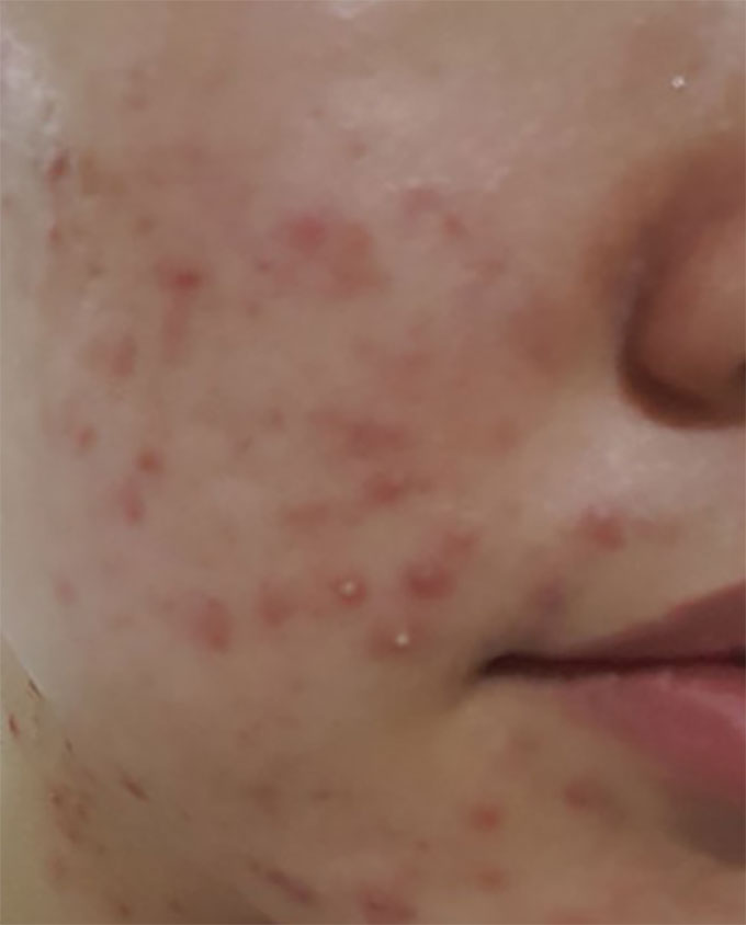 이미지에 대체텍스트 속성이 없습니다; 파일명은 post.jpg 입니다.