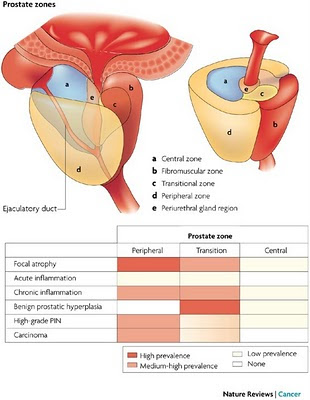 Zonas de la próstata