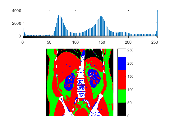 Biomedical Signal and Image Processing projects using Matlab and ...