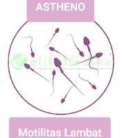 Asthenospermia
