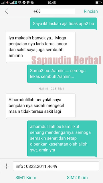 Cara Menghilangkan Benjolan di Tangan