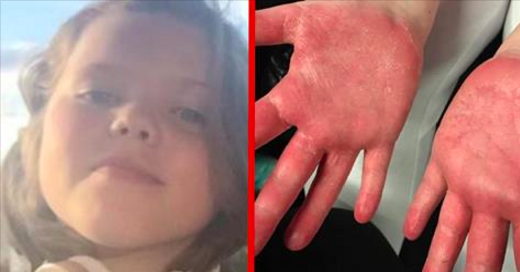 Cette petite fille de 10 ans pense regarder une simple vidéo. Mais quelques heures plus tard, elle voit ses mains et pousse un cri d’horreur.