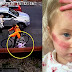 Un cycliste frappe une fillette de 3 ans et la traîne sur 4 mètres, la suite est enrageante!