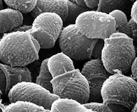 Hongo Malassezia Globosa