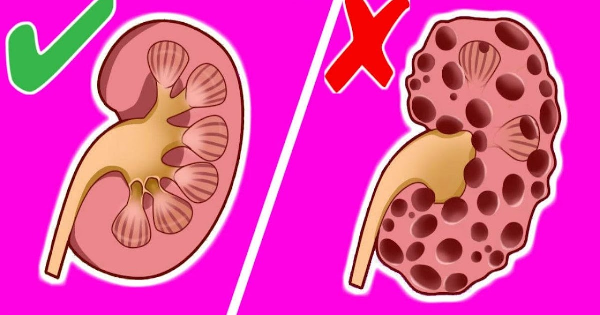 10 Bad Habits That Can Seriously Harm Your Kidneys