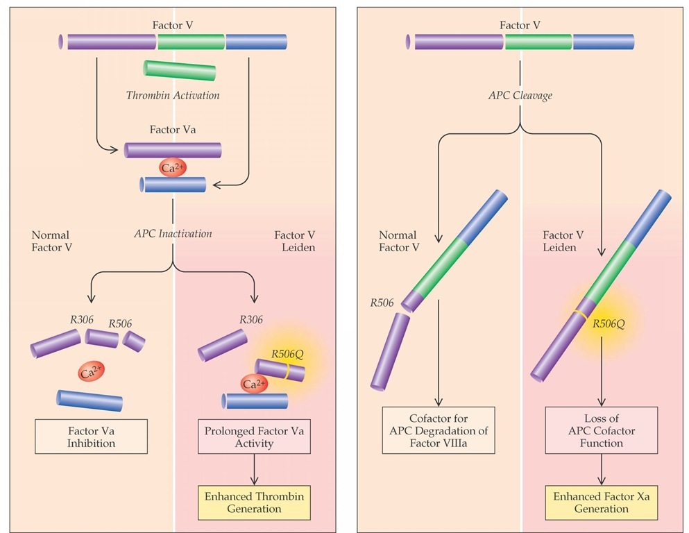 Doença de Crohn novas perspectivas Mutação do Factor V de Leiden