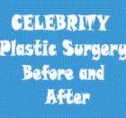 Plastic surgery before and after pictures photos