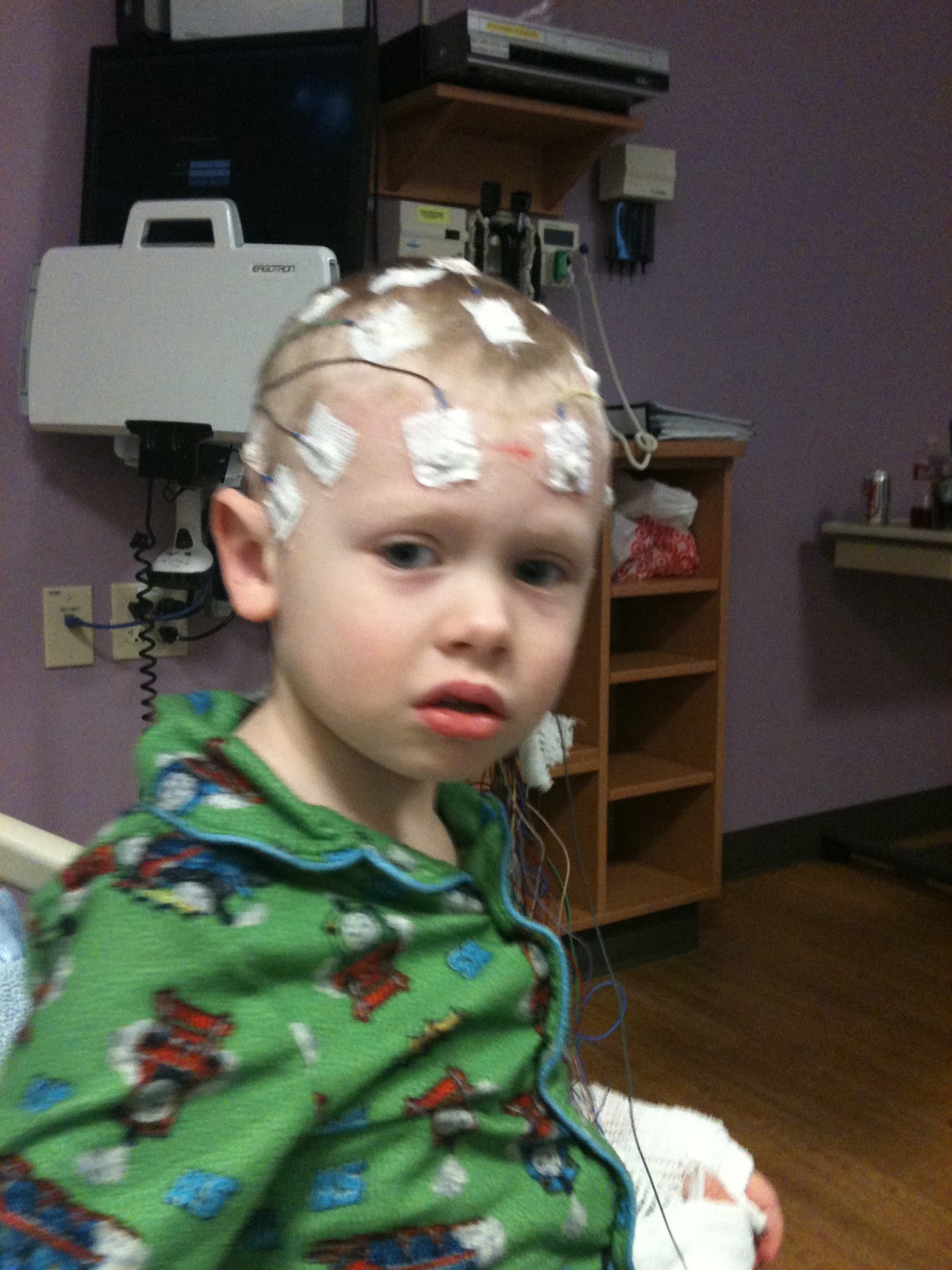 Unlocking Brain Secrets: My 3 Day Home Eeg Journey (Photos) - 1a7hxqp