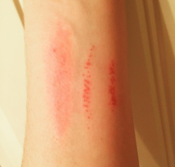 Check out the dangerous 'Eraser Challenge' kids are trying out on social media