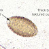 Flatworm Parasite In Human Stool