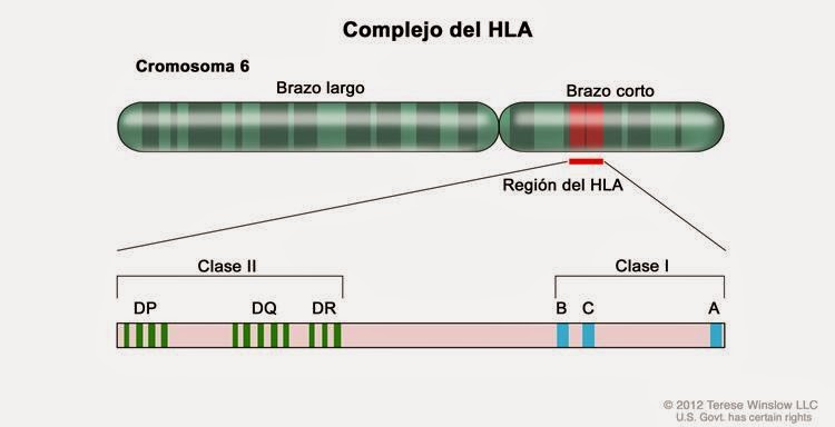 diabetes tipo 1 y predisposición genética
