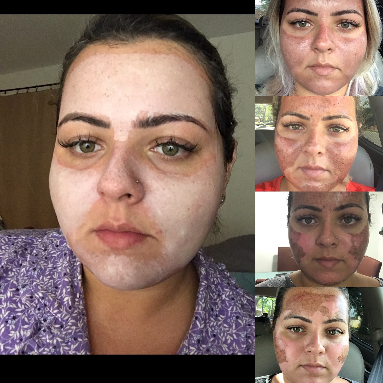 Makeup Artist's Choice Before/After Pics and Testimonials