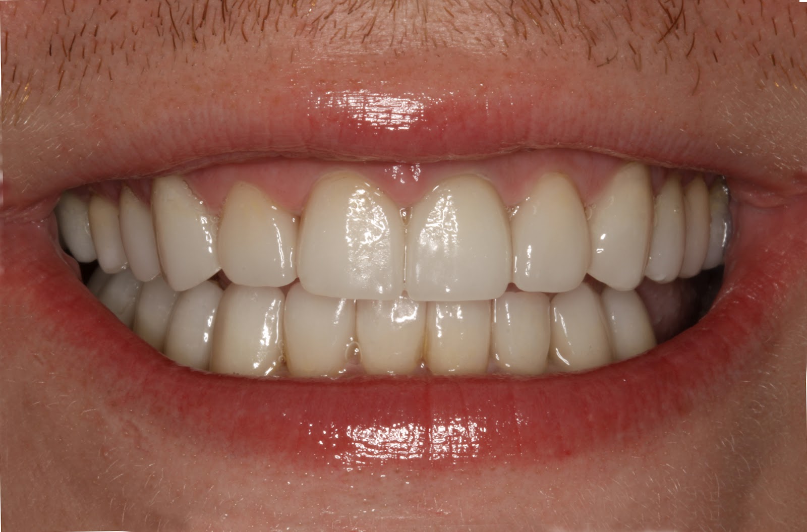 Cosmetic Dentist Cosmetic Dentistry Utah