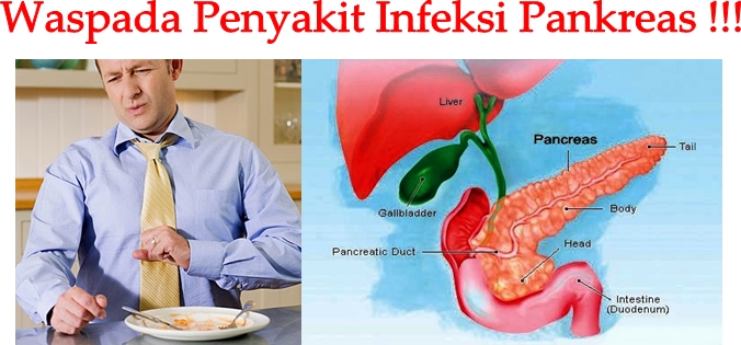 Obat Tradisional Infeksi Pankreas