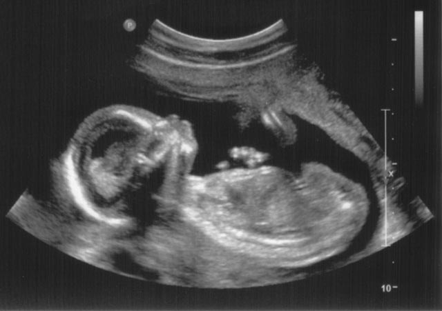 New Developments in OB/GYN Probes