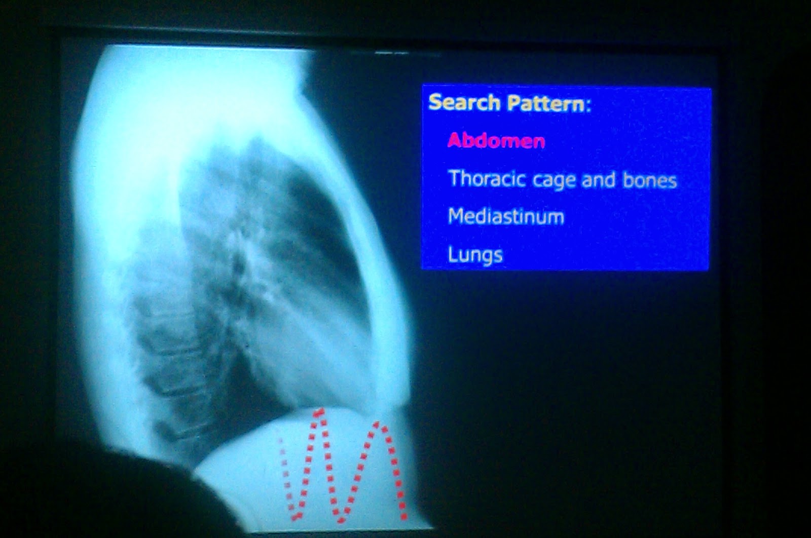 Lecture slides Radiology Chest X ray