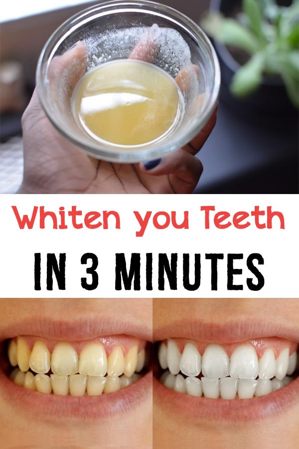 Whiten your teeth in 3 minutes HEALTHYLIFE