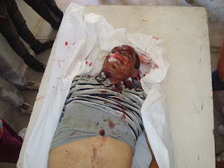 Muere obrero y otro resulta herido en carretera Cabral-Polo