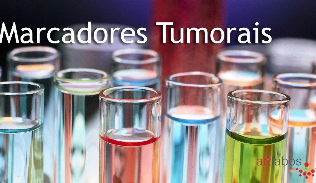 Os Marcadores Tumorais Análises Os Marcadores Tumorais Análises