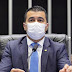 BRASIL | POLÍTICA - "O BRASIL SABERÁ A VERDADE!", diz Deputado Luis Miranda sobre compra de vacinas.
