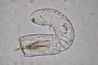 Parasite of the Day Paragordius varius