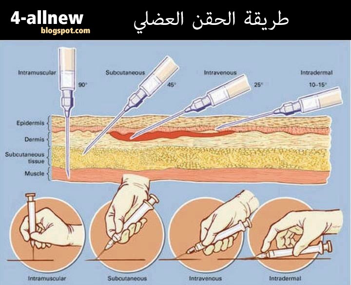 تعلم طريقة الحقن العضلي | Learn how to intramuscular injection