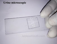 Urine Microscopic deposit slide