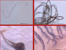 Are these things crawling in your body?