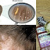 DOCTORS WON’T TELL YOU THIS  CHEAP WAY TO GET RID OF THE HEAD LICE ALMOST INSTANTLY!