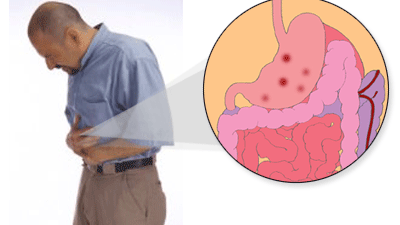 Jangan Asal Minum, kenali Dulu Bahaya Yang Terkandung Dalam Kopi Sebelum Terbuai Kenikmatannya