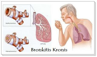 Penyakit Bronhitis