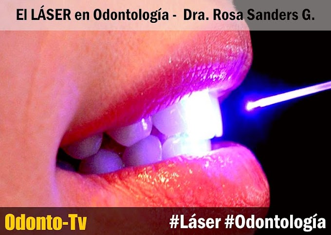 El LÁSER en Odontología - Videoconferencia de la Dra. Rosa Sanders G.