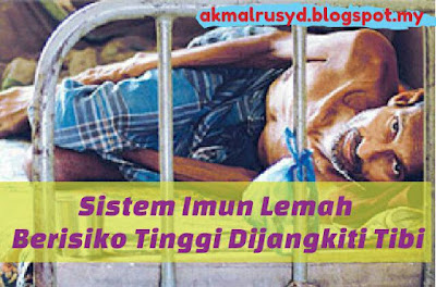 Sistem Imun Tubuh Yang Lemah Berisiko Tinggi Mendapat Penyakit Tibi (Batuk Kering)