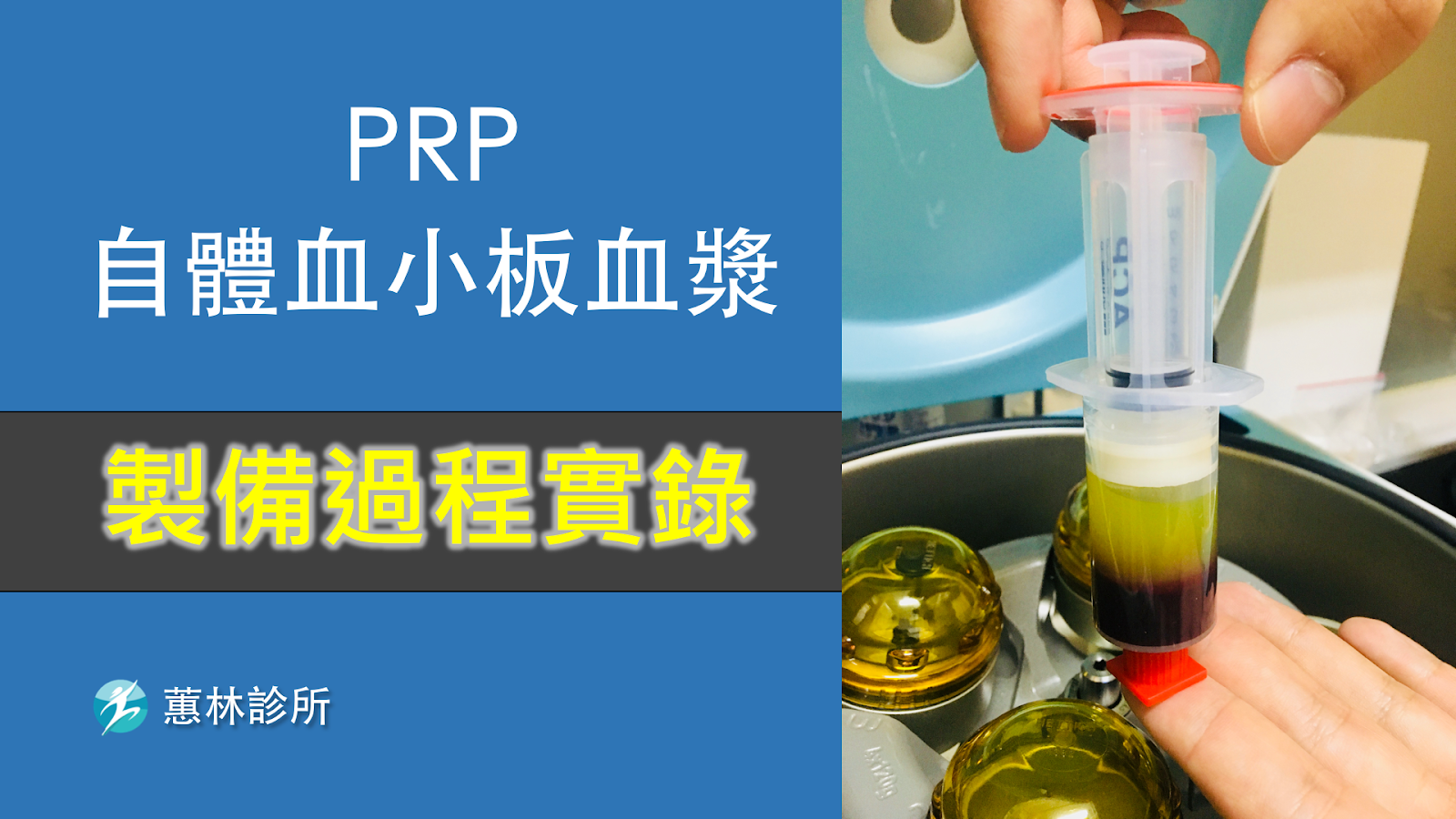 PRP——自体血清注射 年轻十岁不是梦-青海大学附属医院