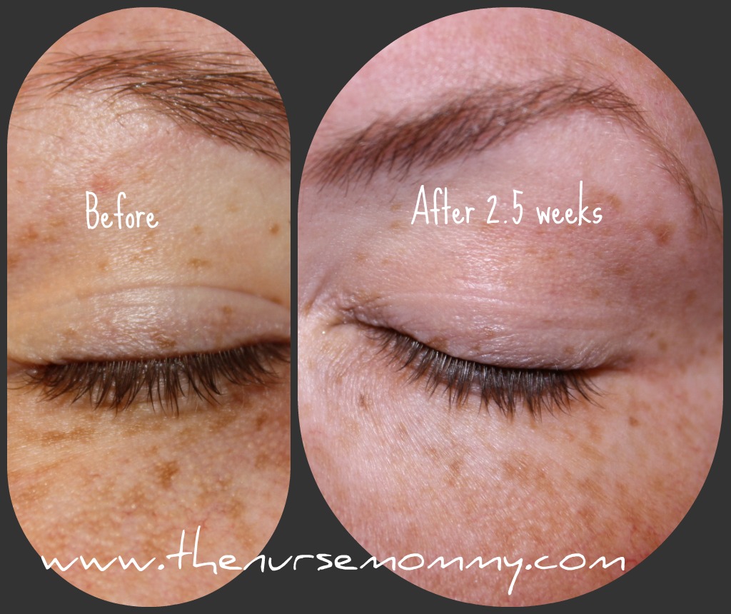 Top Notch Material Win Envy Derm Eye lash Growth Serum to get your Eye