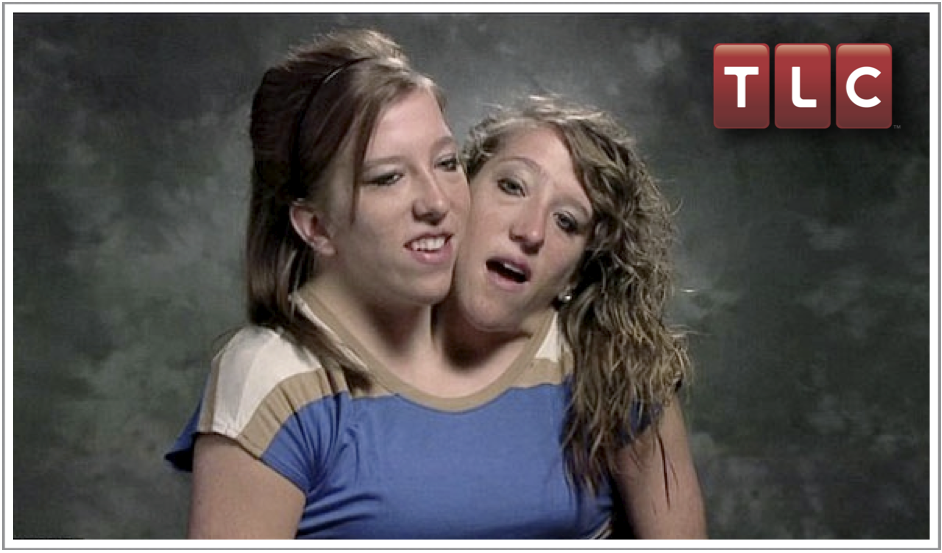 El Crítico de la Tele Abby y Brittany, siamesas con un solo cuerpo que tienen su propio reality