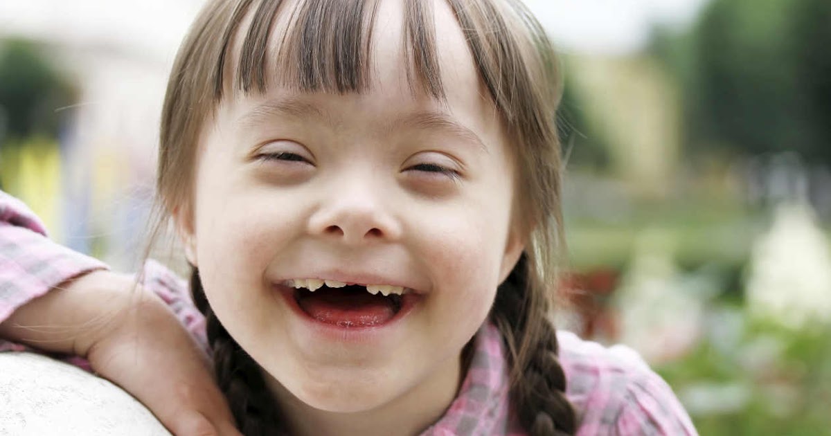 Niños con Síndrome de Down son