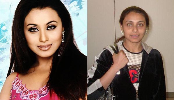 Bollywood Actresses Shocking Photos Before And After Plastic Surgery