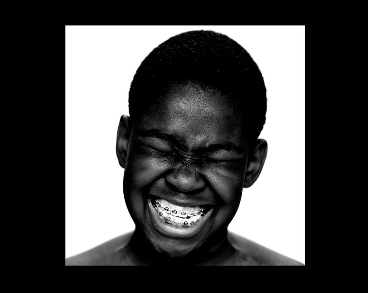 How much it costs to get braces in Nigeria DNB Stories Africa