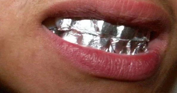  Wrap Your Teeth In Aluminum Foil