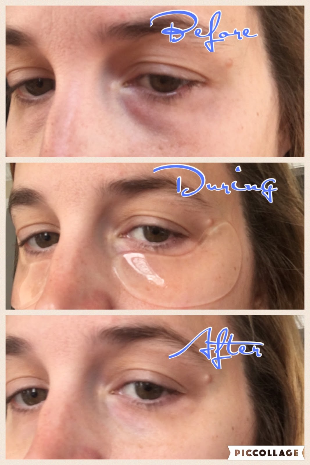 New Age Mama Remove dark circles and fine wrinkles with Frownies Eye