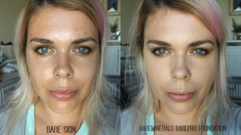 how does botox feel