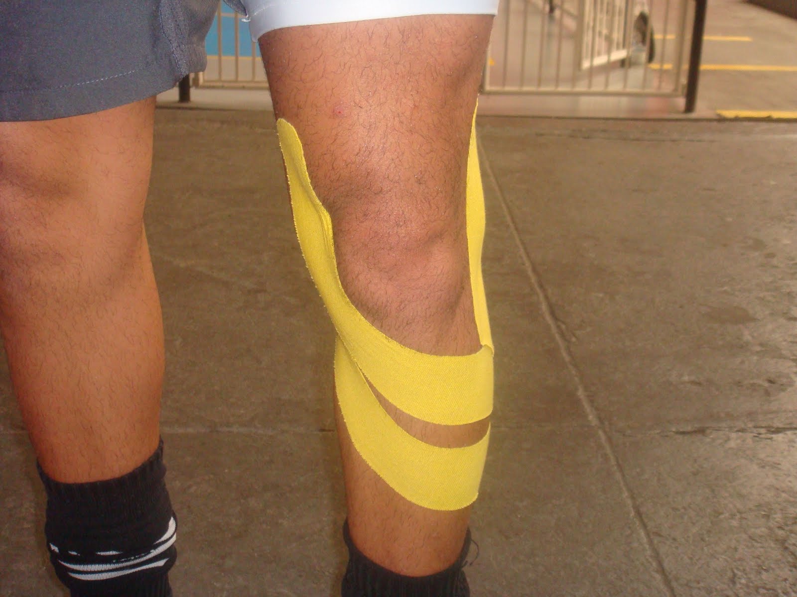 FISIOTERAPIA DESPORTIVA Conheça a bandagem terapêutica, método japonês