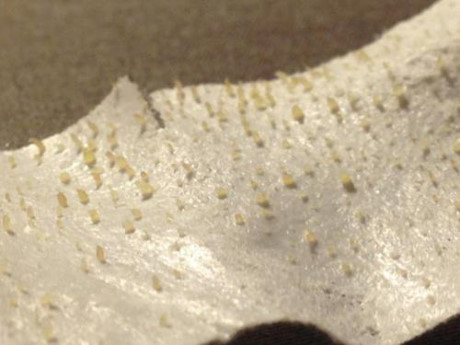 Day la cach giup ban gap mun dau den ra de ot - Anh 2