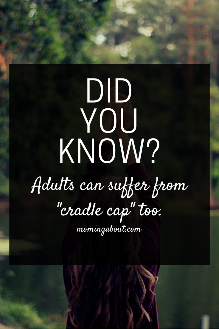 Moming About 4 Ways to Treat Adult Cradle Cap (Scalp Psoriasis)