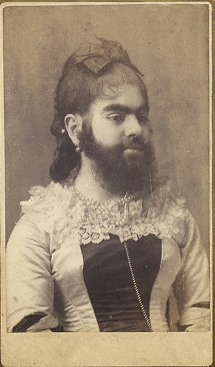 The Bearded Lady Who is the Bearded Lady?